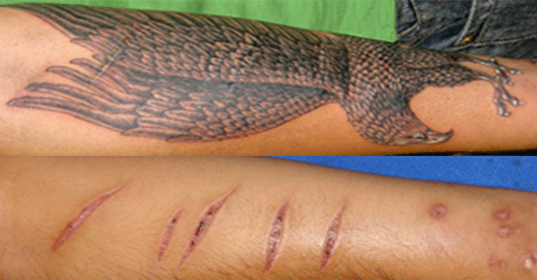 tatuajes en cicatriz 13