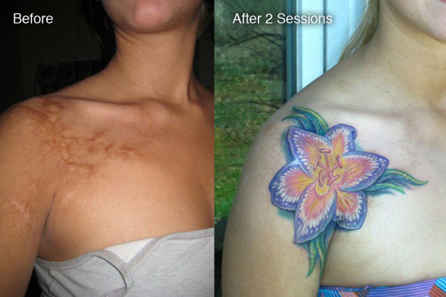 tatuajes en cicatriz 21