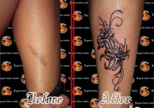 tatuajes en cicatriz 24