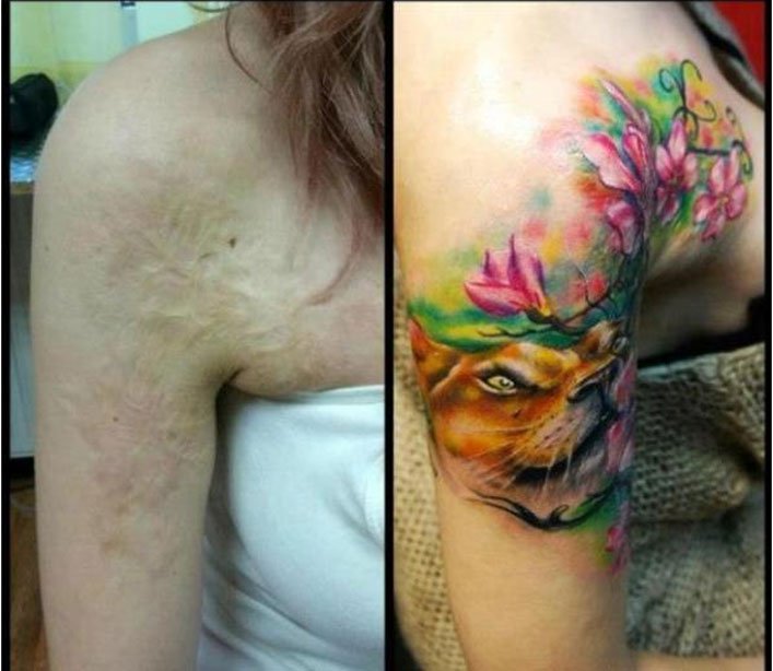 tatuajes en cicatriz 25