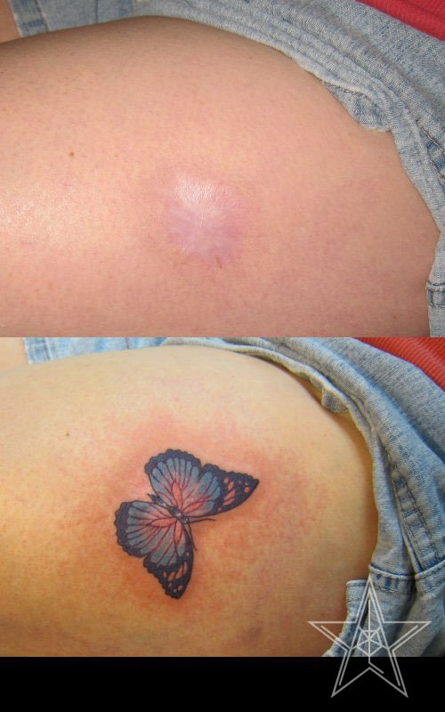 tatuajes en cicatriz 26