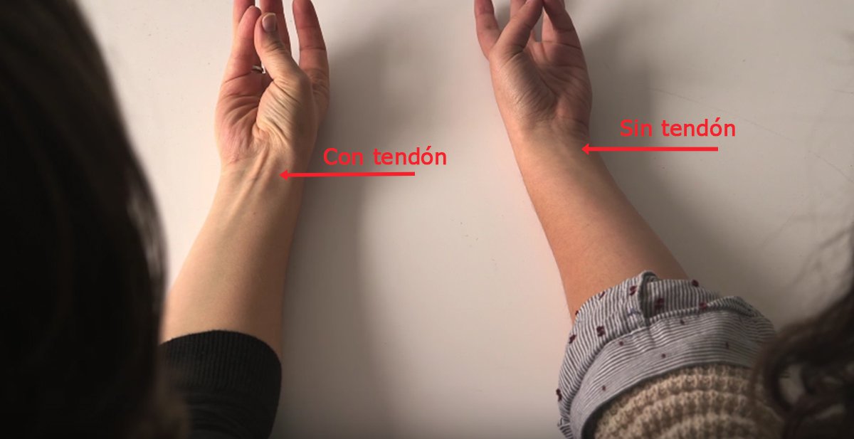 tendón de palmaris longus