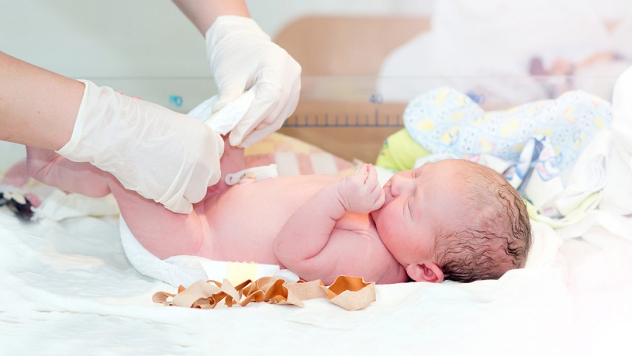 Por Que No Hay Que Cortar El Cordon Umbilical Inmediatamente Al Nacer