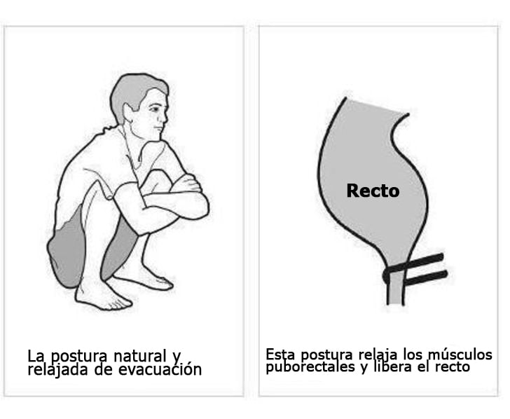 ¿Problemas de estreñimiento? Cómo ir al baño regularmente La voz del muro