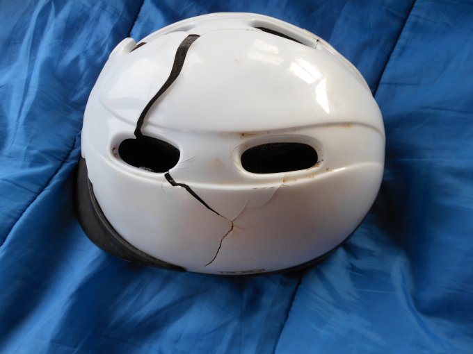 Usar casco: imágenes impactantes que muestran por qué hacerlo.