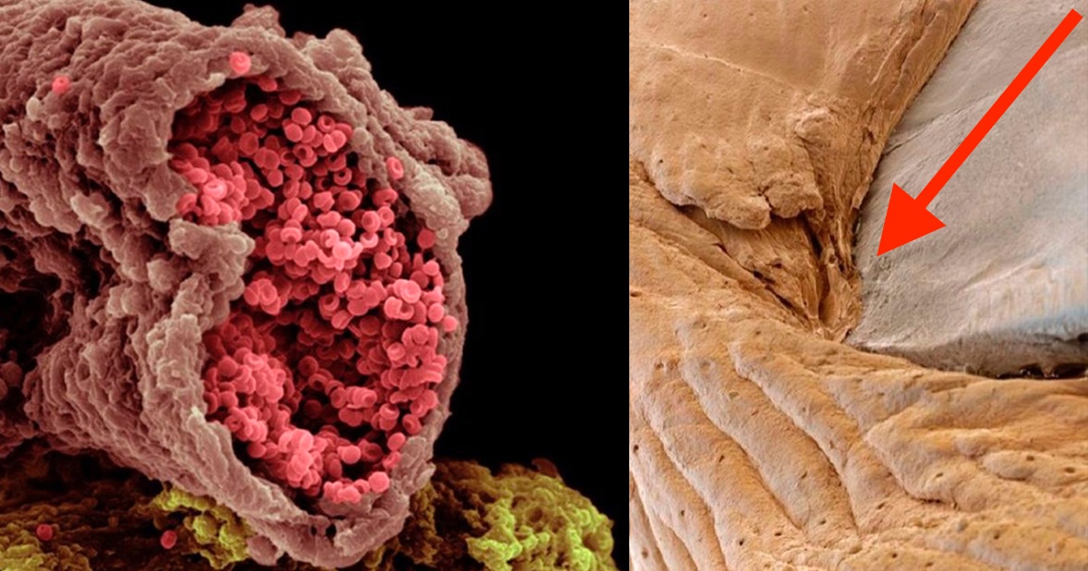 varonil paralelo Cuarto 18 increíbles imágenes del cuerpo humano vistas al microscopio. Trata de  adivinar lo que es