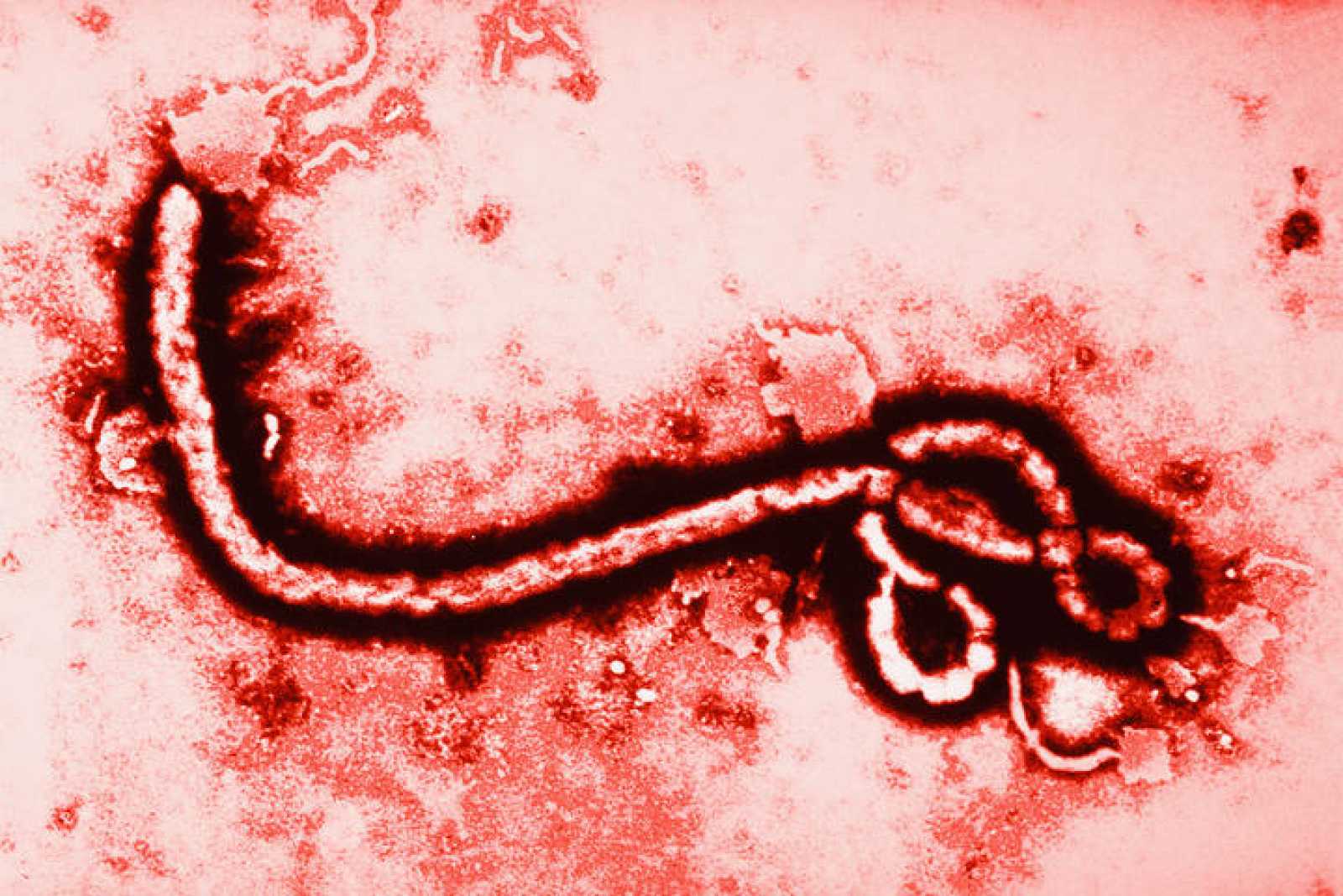 el ébola