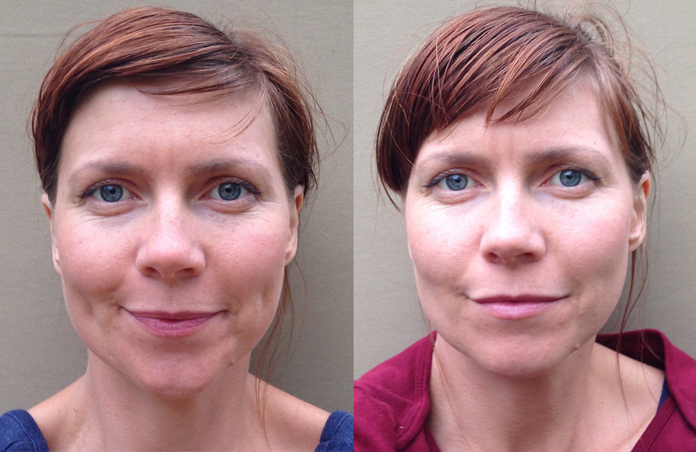 Antes y después del Yoga Facial