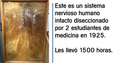 Sistema nervioso humano