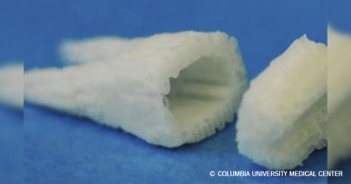implantes-dentales-celulas-madre