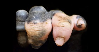 mano-pigmentada-blanca-gorila