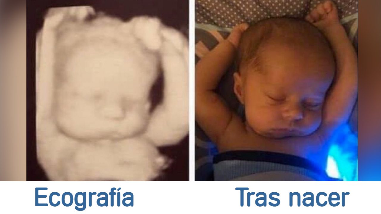 10 Antes Y Despues De Ecografias 4d Y El Bebe Al Nacer