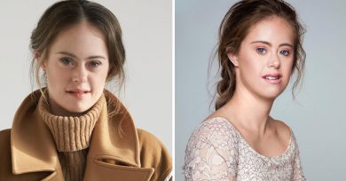 modelo-sindrome-down