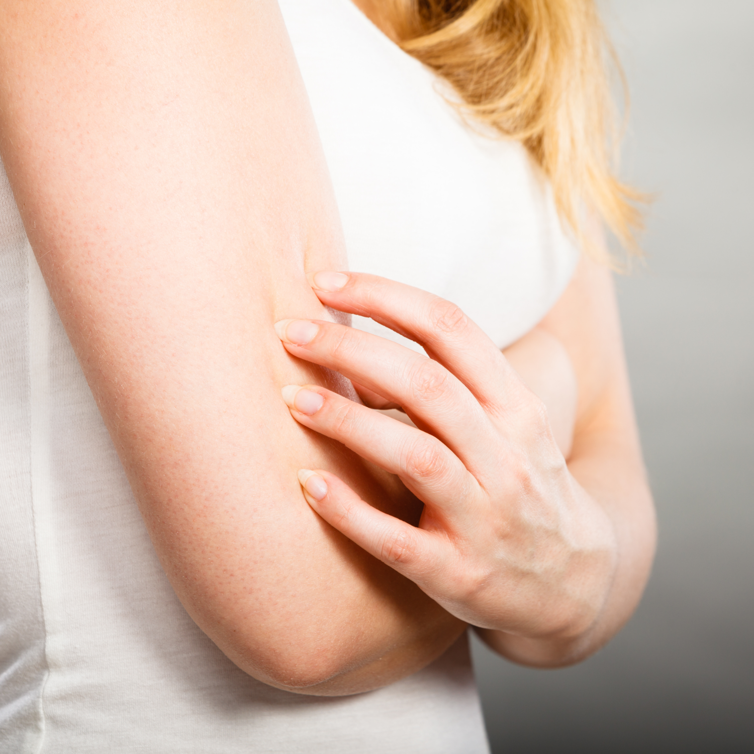 alergia hormonas femeninas