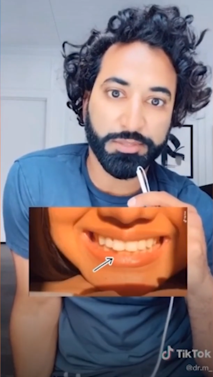 dentista sobre limarse los dientes