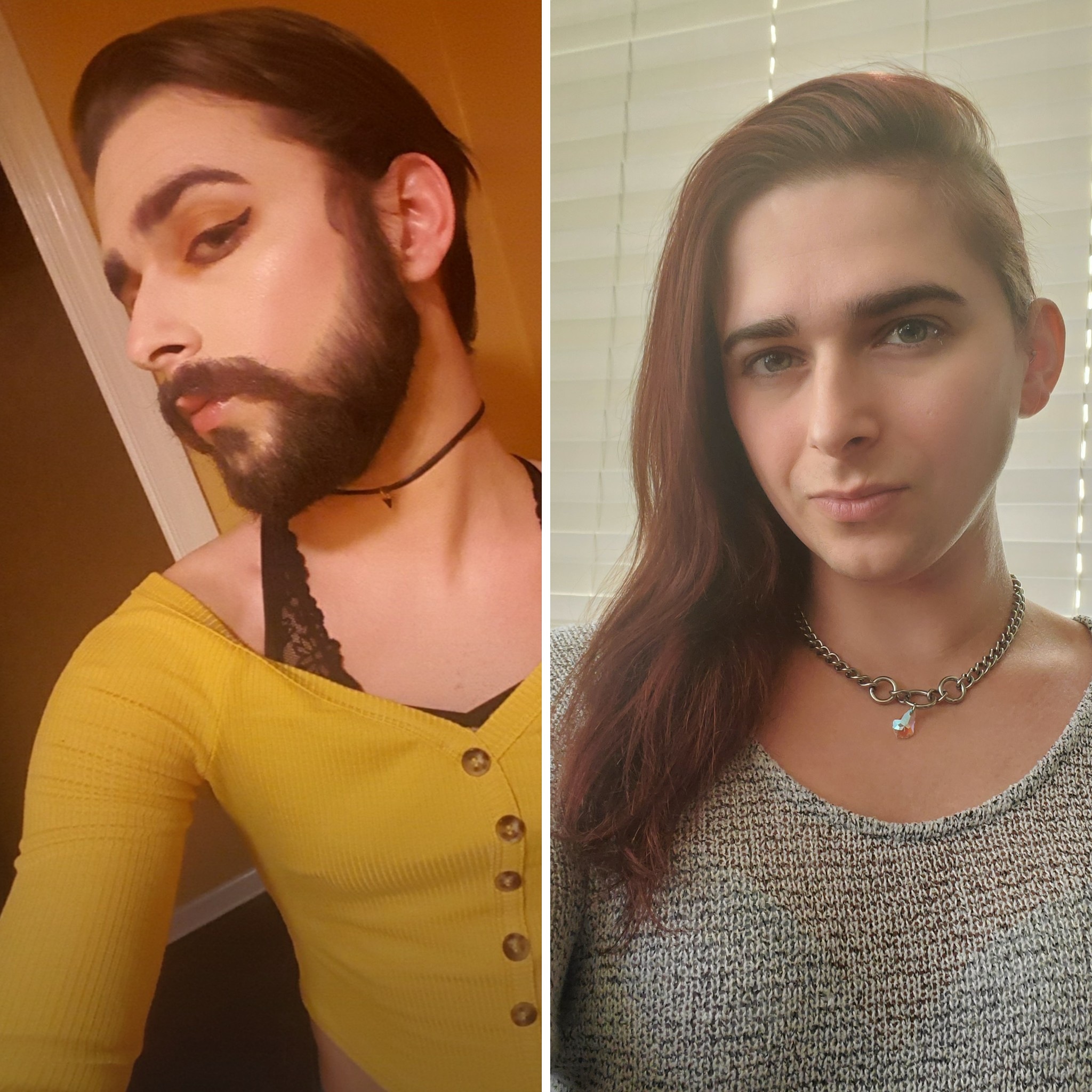 antes y después transgénero