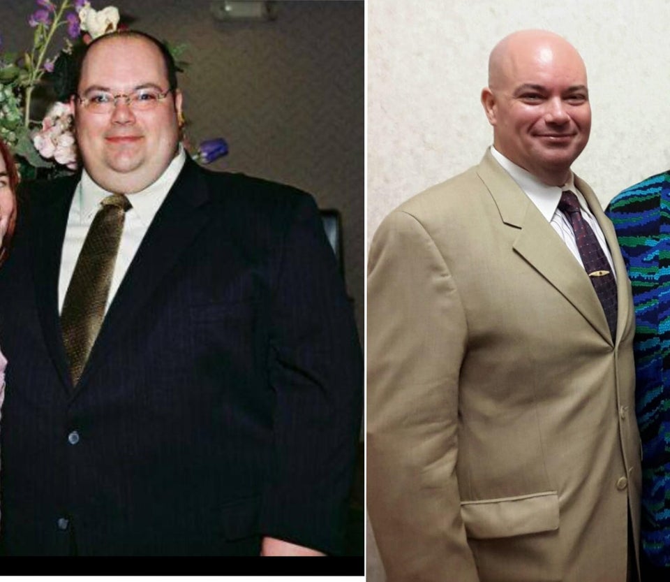antes y después de perder peso