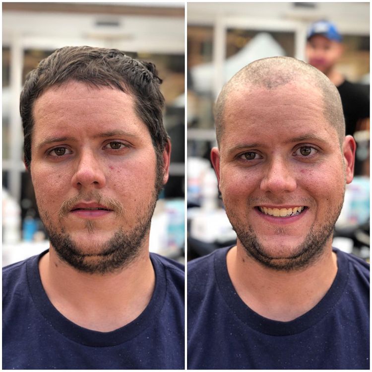 antes y después de raparse la cabeza