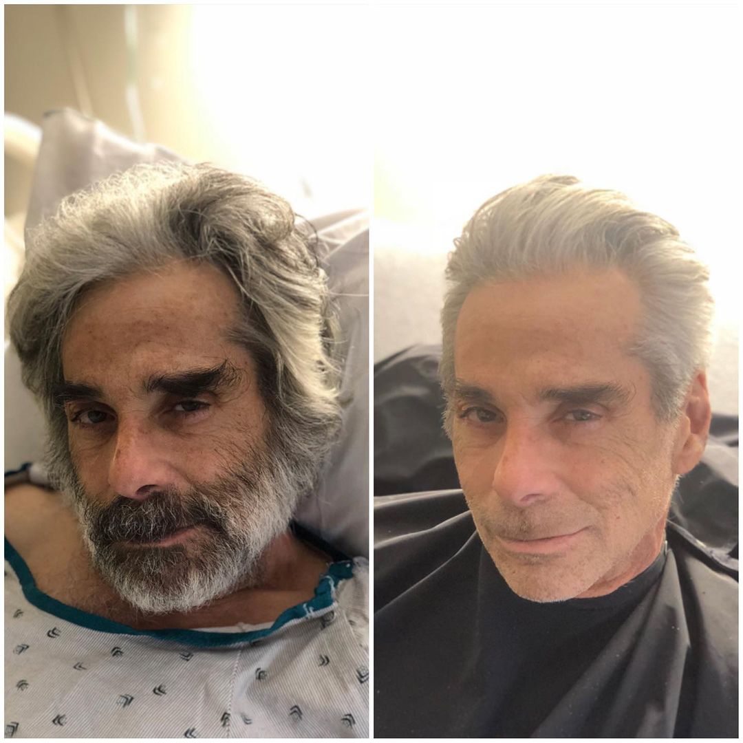 corte de pelo antes y después