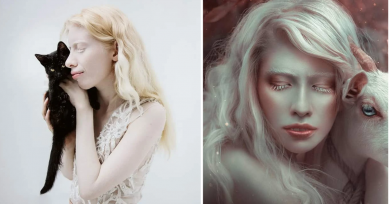 albinismo-modelo